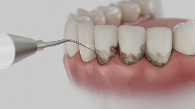 Reliable Dental contractor in Rome, GA by Smile Center Dentistry